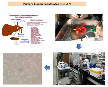 Primary human hepatocyte 분리과정