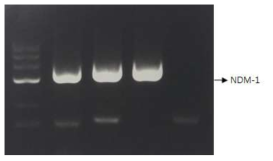 Multiplex PCR을 이용한 E. coli 내성유전자 확인
