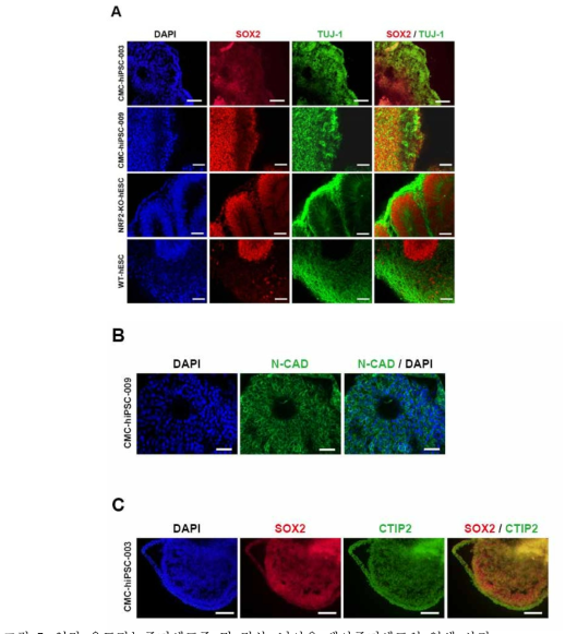 인간 유도만능줄기세포주 및 정상, 넉아웃 배아줄기세포의 염색 사진. (위) CMC-hiPSC-003, CMC-hiPSC-009, NRF2-KO-hESC, WT-hESC 유래 뇌 오가노이드의 신경계 마커 염색 사진. SOX2: 신경 전구 세포 마커, TUJ-1: 초기 뉴런 마커. Scale bar= 100um (CMC-hiPSC-003) 혹은 50um (CMC-hiPSC-009, NRF2-KO-hESC, WT-hESC). (중간) CMC-hiPSC-009 유래 뇌 오가노이드의 신경 로젯 부위 염색 사진. N-Cadherin