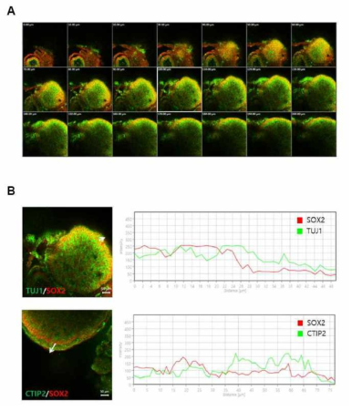 인간 유도만능줄기세포주 유래 뇌 오가노이드의 3차원 구조 분석. (위) CMC-hiPS-003 유래 뇌 오가노이드의 Z-stack 촬영 사진. SOX2 (적색): 신경 전구 세포 마커, TUJ-1 (녹색) : 초기 뉴런 마커. (아래) CMC-hiPSC-003 유래 뇌 오가노이드의 촬영 사진 및 위치에 따른 형광 강도 측정. SOX2: 신경 전구 세포 마커, TUJ-1: 초기 뉴런 마커, CTIP2: 대뇌 피질 뉴런 마커. 그래프 X축: 흰색 화살표 시작점으로부터의 거리, Y축: 형광 세기