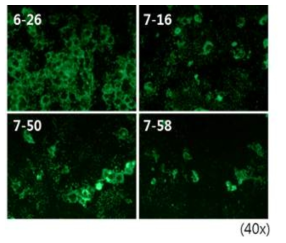 3차 감염 중인 분리주 리케치아 면역형광염색법. Primary Ab: anti-R. japonica, Secondary Ab: anti-mouse IgG (H+L) FITC conjugated