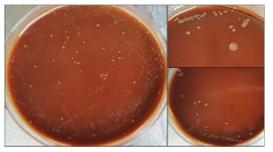 B. quintana colonies 확인 및 동정. B. quintana shows variable colony morphology on chocolate agar or columbia agar with 5% sheep blood. The circular brownish and rough colonies with a humid embedded on agar are obtained after 7 to 10 days culture