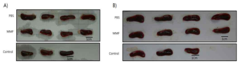 MMF 투여에 의한 H5N1-VN 감염 마우스의 비장 비대증 완화 확인.H5N1-VN 바이러스를 1mLD50로 감염한 후, MMF를 50mg/kg/day로 7일간 투여 하였다. 감염 후, (A) 3일, (B) 6일, 마우스의 비장 이미지. 이미지 하단의 검은 바는 1cm를 나타냄