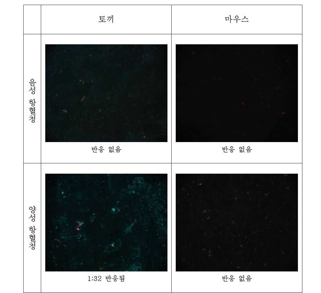 발진열 검출용 항원슬라이드(자체제작)를 이용한 IFA 결과