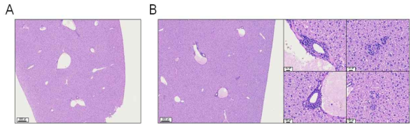 A. phagocytophilum KZ-A1 감염 후 14일 차 C57BL/6 마우스의 간 H&E 염색 결과