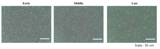 EGM-2 배양액을 사용하여 배양 후 세포의 모양