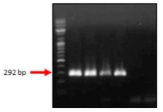 쯔쯔가무시증 종 특이유전자 primer의 증폭 확인. Lane M: 100bp marker, lane 1: Gilliam, lane 2: Karp, lane 3: Kato, lane 4: Boryong, lane 5: Negative control, lane 6: DW