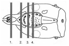 Histological sections of nasal cavity