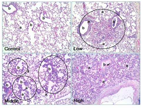 Histological features of representative lung of each ITI study group. Note the normal pulmonary morphology with bronchioles (b) and alveoli (a). In Low, note the focal acute inflammation with hemorrhage (circle) and also note the bronchiole filled with neutrophils (b). In Middle, note the multifocal inflammation around the terminal bronchioles (b) and in the associated alveolar ducts and alveoli (a). In High, note the diffuse fibrinous pulmonary edema (a) with severe necrosis of alveolar epithelia (arrows in b). H&E. Mag.=X100