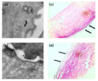 Histological images of skin tissues treated with AgNPs. AgNPs were observed in stratum corneum. (a) Ag 20 nm, (b) Ag 50 nm by TEM and (c) Ag 20 nm, (d) Ag 80 nm with hematoxylin and eosin stain