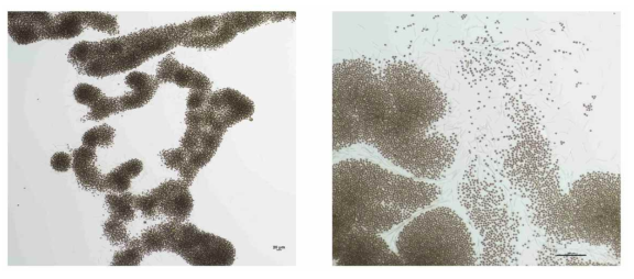 녹조 발생시의 남조류 M icrocystis의 현미경 사진