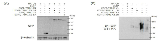 Expression and in vivo Ub assay of TRIM1-X1 and –X2 in HEK293T cells