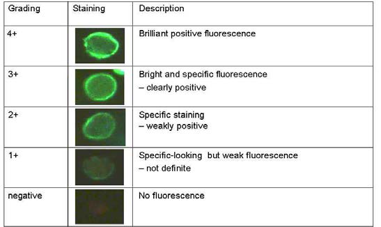 면역형광 염색 정도의 Grading 지표 정의