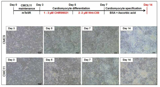 CMC9, CMC11 세포주의 심근세포 분화 방법