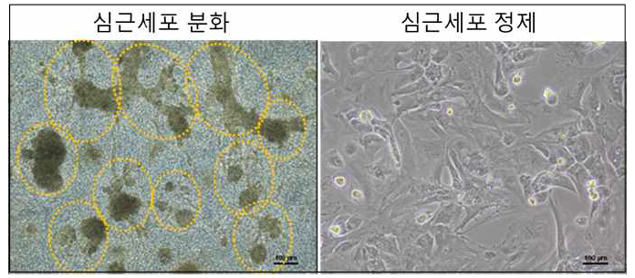 심근세포 분화 및 정제