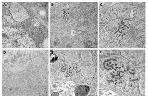 전자현미경 (electron microscope)으로 ebola VLP 생성 확인 (A; plasmid가 도입되지 않은 S2 세포, B  Zaire ebolavirus isolate Guinea의 GP, NP, VP24 그리고 VP40 유전자 클론이 도입된 S2세포, D; plasmid가 도입되지 않은 S2 세포, E  Bundibugyo ebolavirus isolate Bundibugyo의 GP, NP, VP24 그리고 VP40 유전자 클론이 도입된 S2 세포)