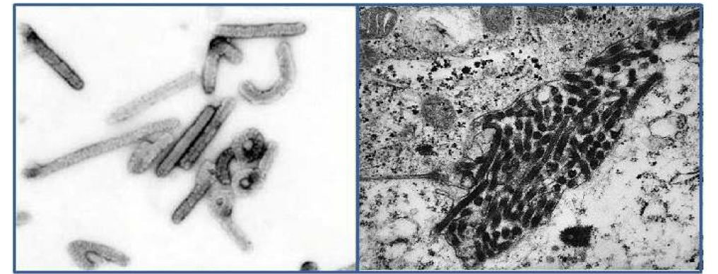 마버그바이러스 현미경 사진 (CDC, USA)
