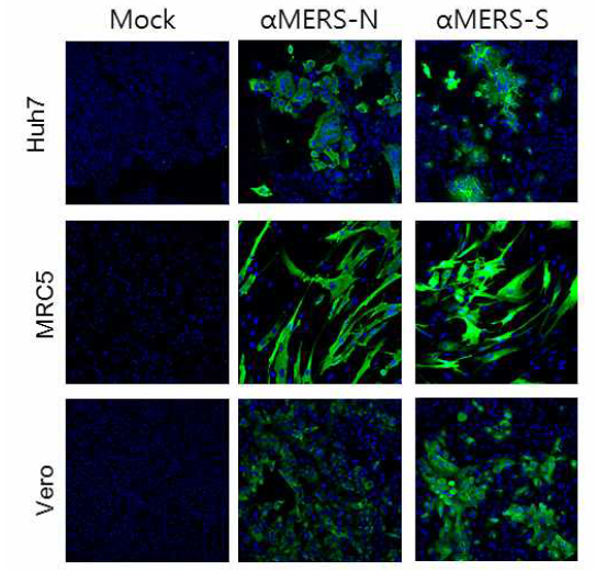 면역형광분석법을 이용한 세포내 메르스 코로나바이러스 항원 확인