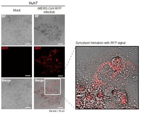 형광발현 전장클론으로부터 복원된 형광발현 재조합 바이러스 P0를 Huh7에 감염시켜 48시간 후에 RFP를 confocal microscopy로 촬영한 사진. 우측에 확대한 사진에는 감염된 세포에서 나타나는 CPE의 특징인 syncytium이 형성되어있는 모습