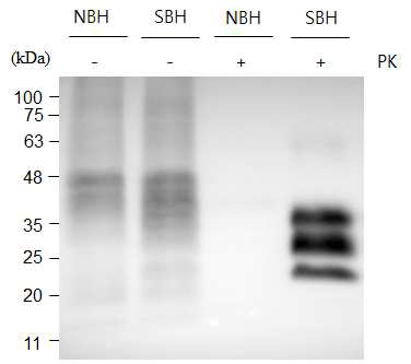 Western blotting of RML sick brain homogenate (SBH) and uninfected normal brain homogenate (NBH) before and after PK digestion