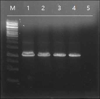 각 재조합 균주 내 p24 유전자의 존재 확인을 위한 콜로니 PCR 결과. M, 1kb DNA ladder; Lane 1, BCG-pMV306-p24; Lane 2, SNUMI-8-pMV306-p24; Lane 3, SNUMI-9-pMV306-p24; Lane 4, positive control (pMV306-p24 construct); Lane 5, negative control (distilled water, DW)