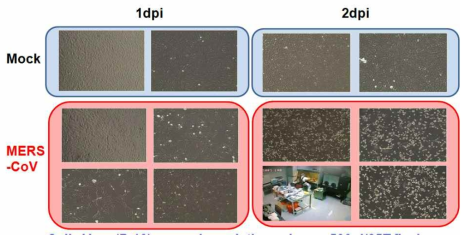 MERS-CoV CPE 확인