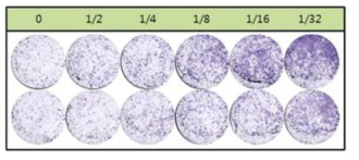 Crystal violet 염색으로 CPE 확인