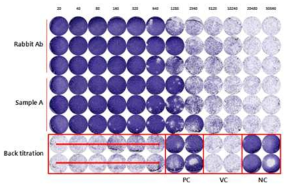 TCID50기법을 이용한 중화항체가 측정