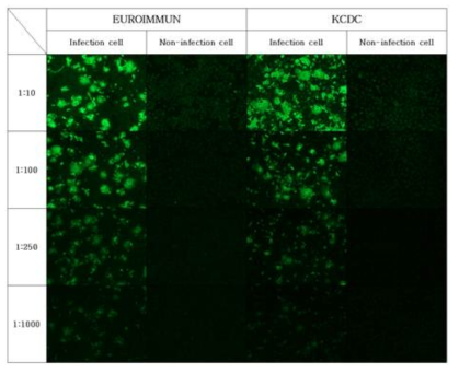 MERS 환자 혈청에 대한 KCDC-IFA 진단 표준화