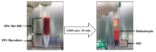 19% Nycodenz-KCl법을 이용한 미성숙적혈구 수집