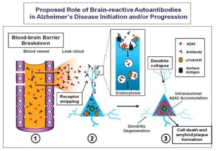 A generalized mechanism for AD pathogenesis with two major contributing factors: breakdown of the blood-brain barrier (BBB) and presence of neuron-binding autoantibodies in the serum