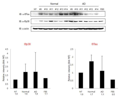 정상인 및 치매환자 유래 혈액 처리 후의 p38 및 Tau의 활성화 비교