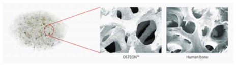 합성골이식재 (자료: ㈜제노스 OSTEON)