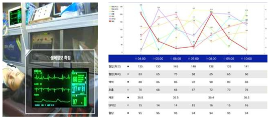 이송 중 평가 생체정보 내용(혈압, 맥박, 호흡, 체온 등) 수집