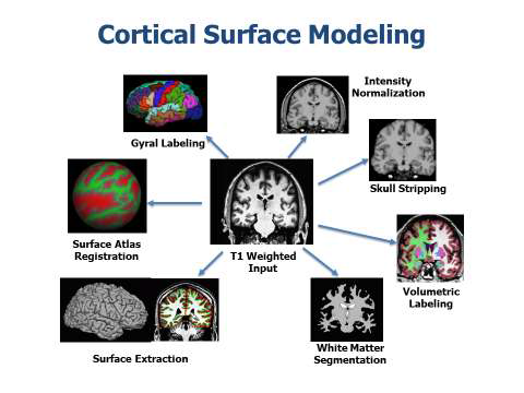 Cortical 표면 Modeling