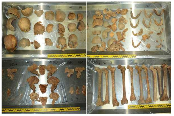 Skeletonal remains were classified by anatomical structure and analyzed by anthropological and odontological examination