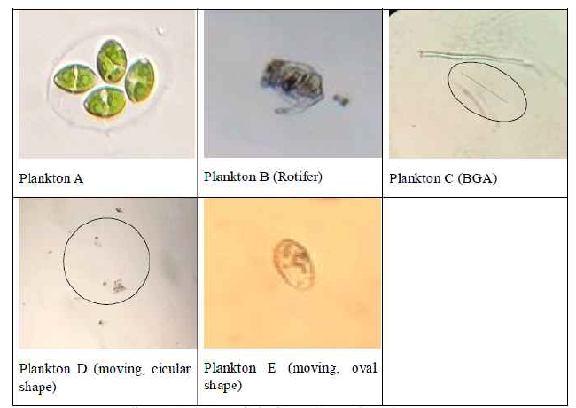 Types of plankton view under microscope