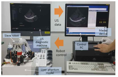 초음파 영상진단 시스템과 진단 로봇 시스템의 통합 및 팬텀실험 장면