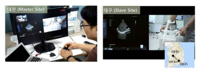 대전본원(마스터) – 대구센터(슬레이브) 간 원격초음파 실험