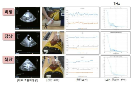 복부 초음파 팬텀을 이용한 진단 타겟 도출 및 진단 모션 주파수 분석 결과