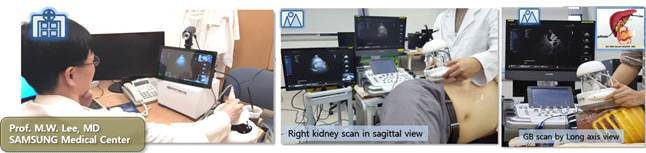 실험1. 복부 질환의 원격초음파 영상진단 적용 및 가능성 검증