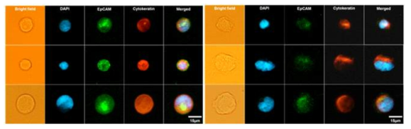 (좌)MCF-7 세포, 및 (우)MDA-MB-231 세포의 형광면역염색 결과 (파란색: 세포핵, 녹색: 표피세포부착분자, 빨간색: 암세포)
