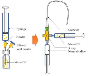 Catheter-connected infusion system