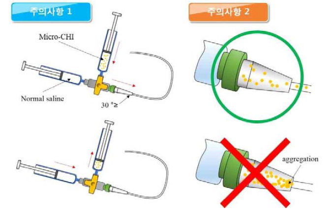 Catheter-connected infusion system의 주의사항
