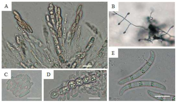 클로탈라리아 시들음 증상에서 분리한 Fusarium udum균의 형태적 특성. A, 자낭 및 자낭포자; B, 분생포자경; C, 소형분생포자; D, 후벽포자; E, 대형분생포자