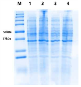 E . coli BL21(DE3) 발현 균주에서의 단백질 발현 양상