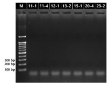 미니 트리에서 추출한 RNA의 RT-PCR 결과-2