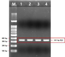 AS1 이용 cDNA를 Template로 한 PCR 결과, 331 bp 예상