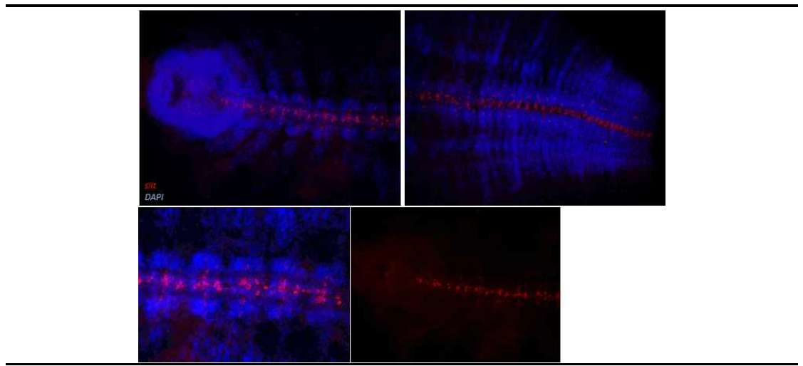 신경계형성유전자 slit1의 지렁이 배아의 신경계 발생동안의 발현양상