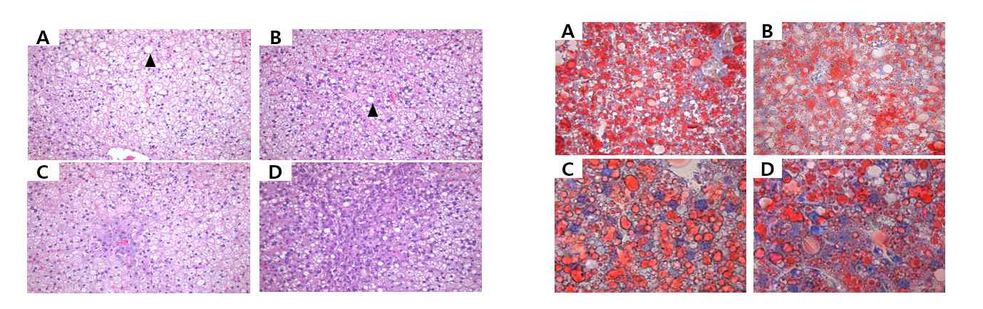 건분 농축시료 기능성 확인 동물연구 (2차) 간조직 H&E 및 ORO 결과